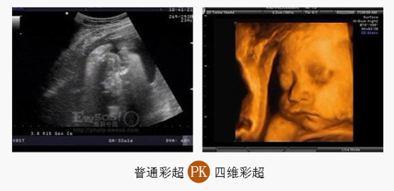 孕期检查，为您和宝宝撑起健康的保护伞