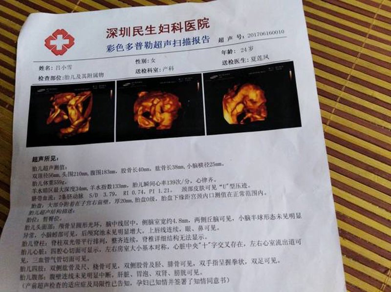 四维彩超：走进未来医疗的窗口